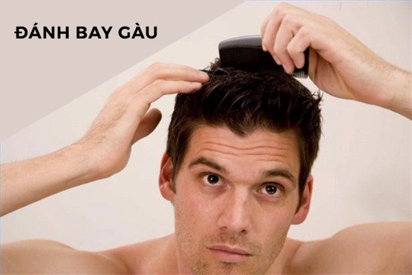 Stress là một trong những nguyên nhân có thể dẫn đến tình trạng rụng tóc (Nguồn ảnh: Alobacsi.com)